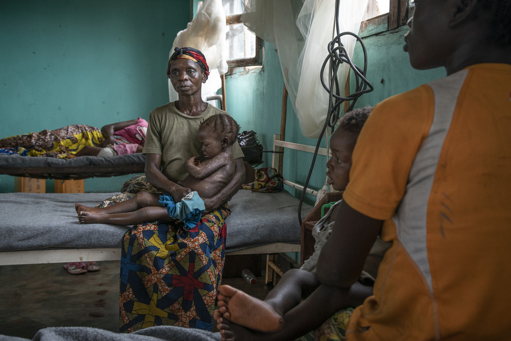 msf316409_medium.jpg Wanea Mabele, 40, holds her daughter Dobo, 3, who suffers from an advanced stage of measles