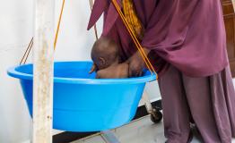 A mother places her son in a basin scale to be weighed in the emergency unit at the MSF-supported Bay Regional Hospital in Baidoa, Somalia. Basin scales are commonly used to weigh infants and young children as part of routine health screening.