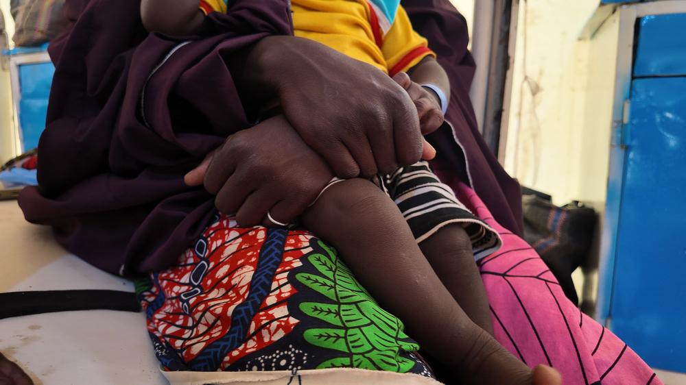 After several weeks of free medical and nutritional care, both children are recovering, highlighting how timely treatment can save lives when malaria is complicated by other illnesses.