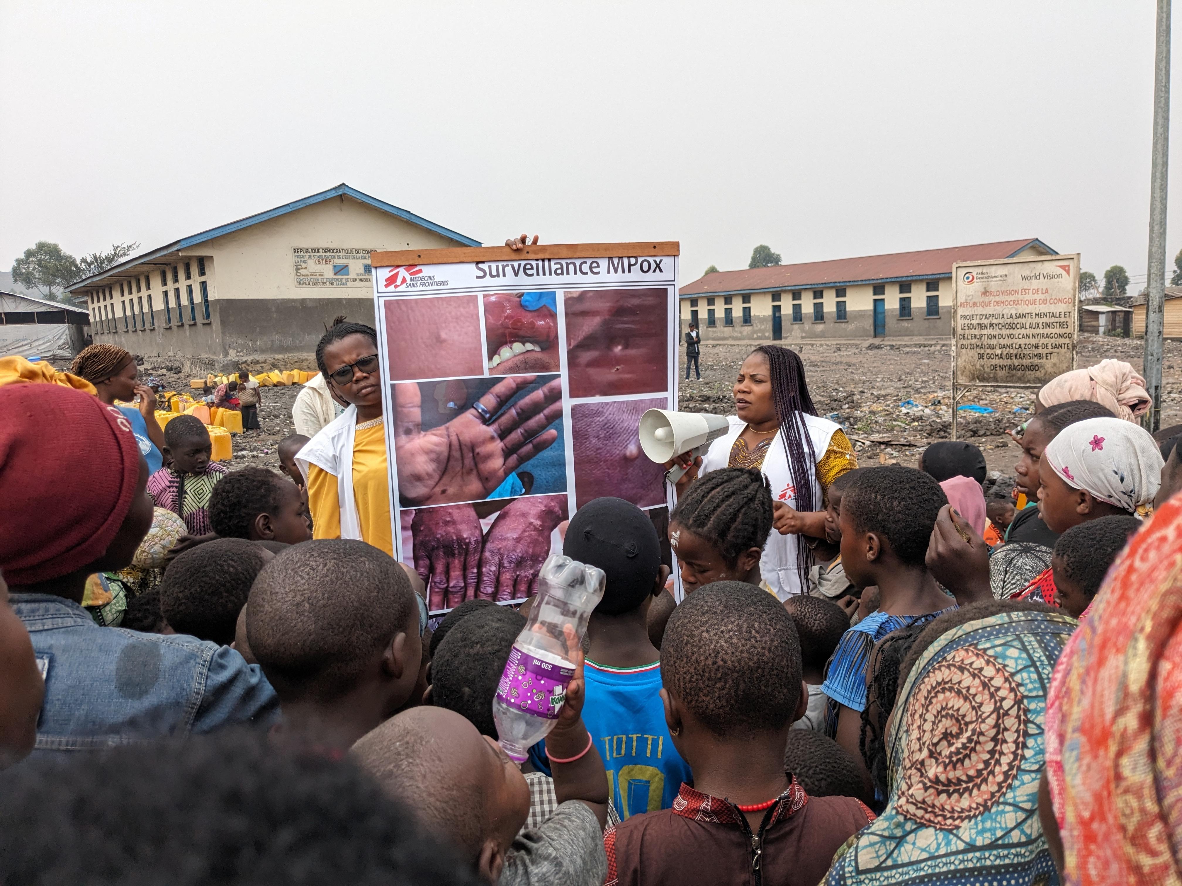 The Mpox epidemic is increasingly affecting people displaced by armed conflict in Goma, North Kivu