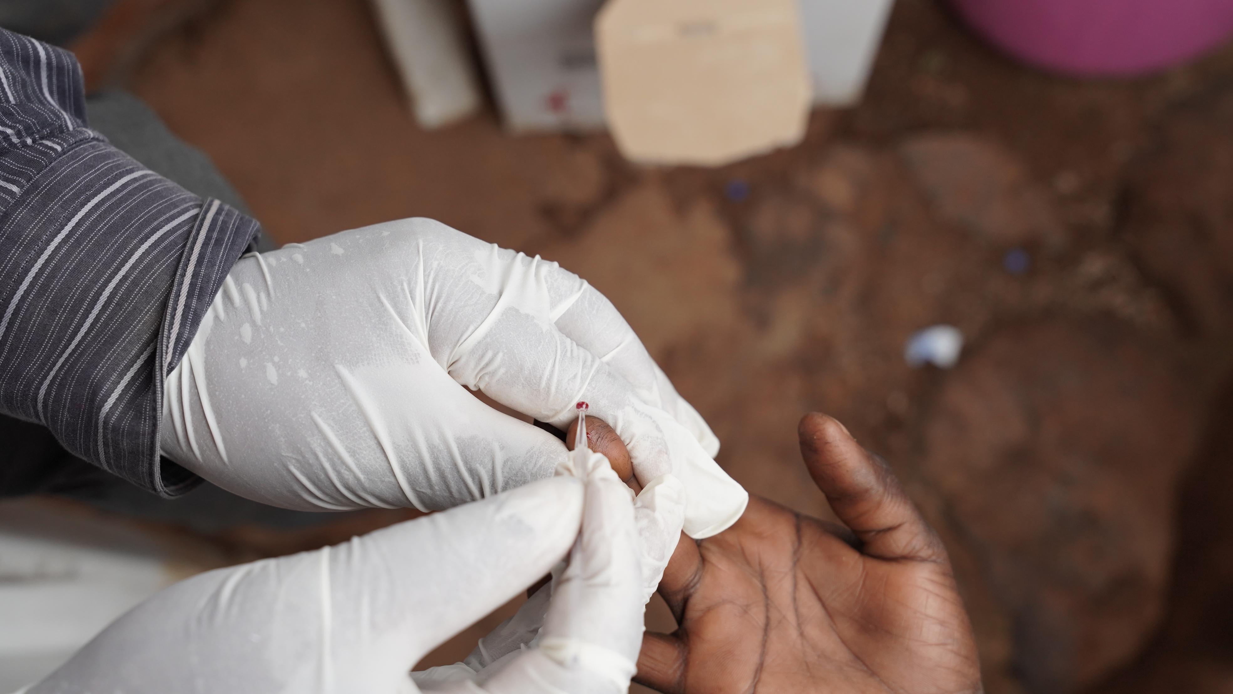 MSF outreach staff collecting a blood sample to test for malaria.