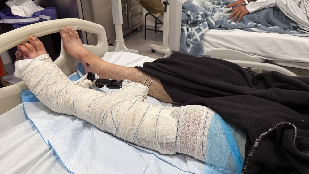 After months of displacement, this young man and his friend tried to return to their hometown in southern Lebanon. They never made it home.Israeli shelling and a drone strike hit them on the way. His friend was killed. He lay injured for hours before paramedics could safely reach him, as ongoing attacks prevented rescue efforts.